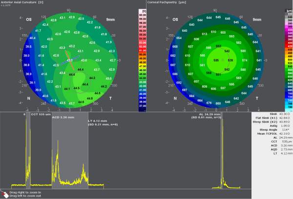 For customers with a normal eye and no need for a premium IOL, this display is all you need for cataract screening.