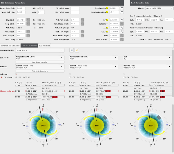 Spherical and Toric IOL Power Calculators - A complete range of formulas to predict spherical, toric or post-refractive IOL power.