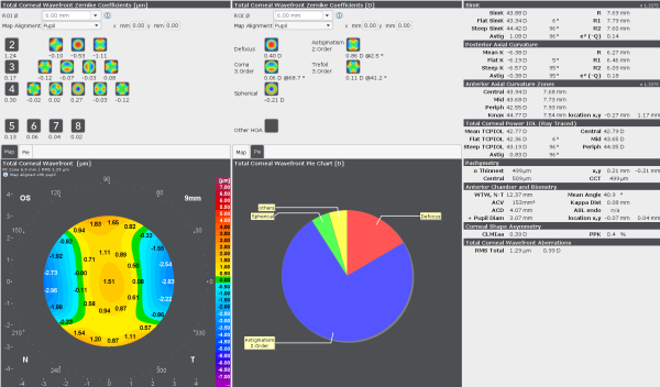 Measuring high-order aberrations with the Wavefront Display of the GALILEI helps identify the most suitable IOL for cataract patients and allows custom treatments for refractive patients. 